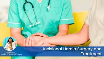 best Incisional  Hernia surgeon in Delhi